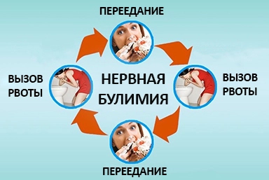 Лечение булимии в Мацесте